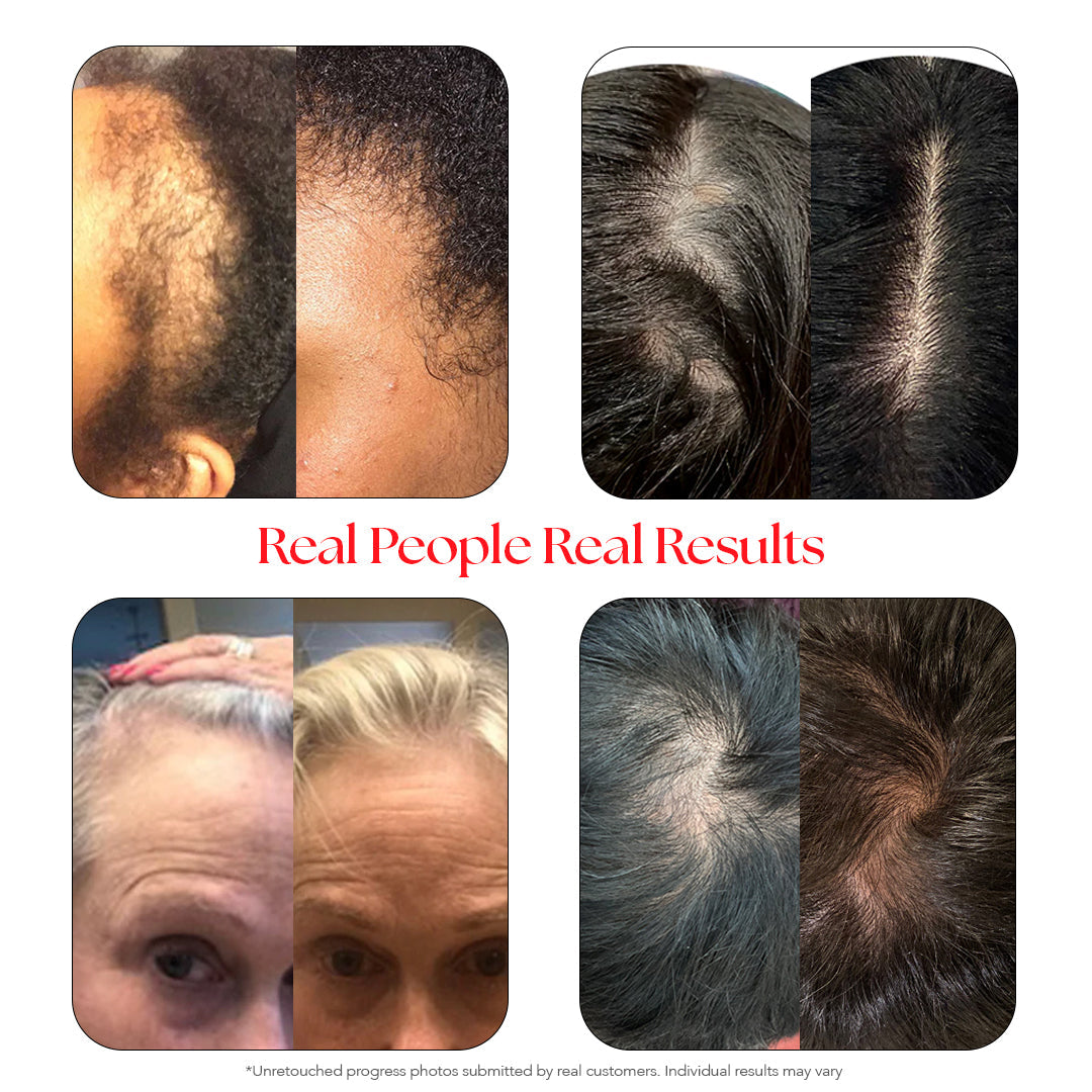 Gorgeous Growth Scalp Serum
